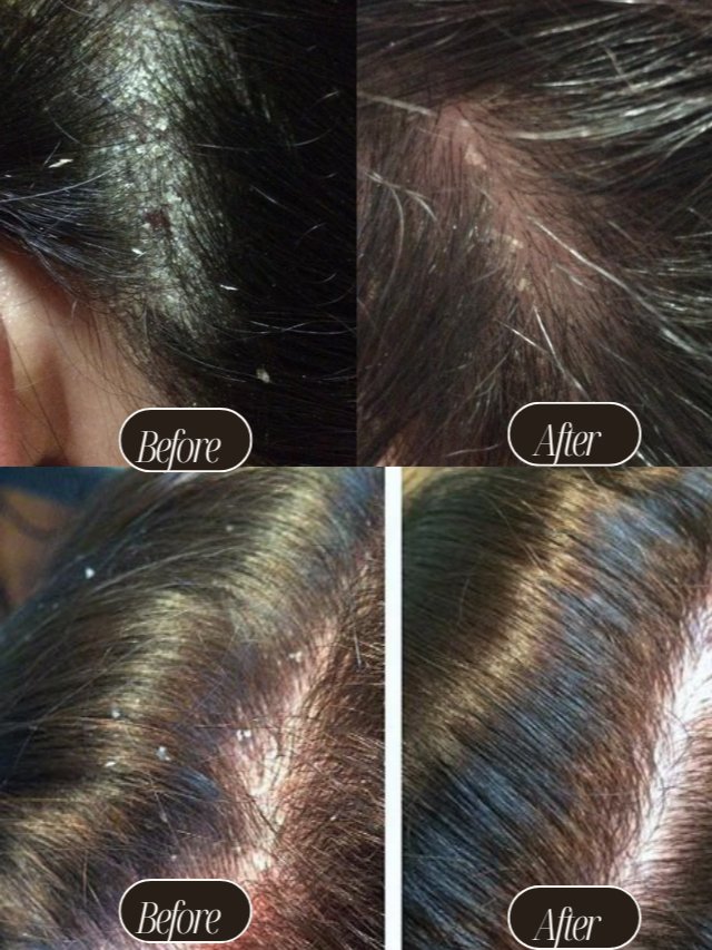 Get Fuller, Healthier Hair in Just 60 Days product image (3)