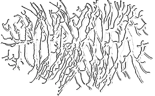 Hypermania
