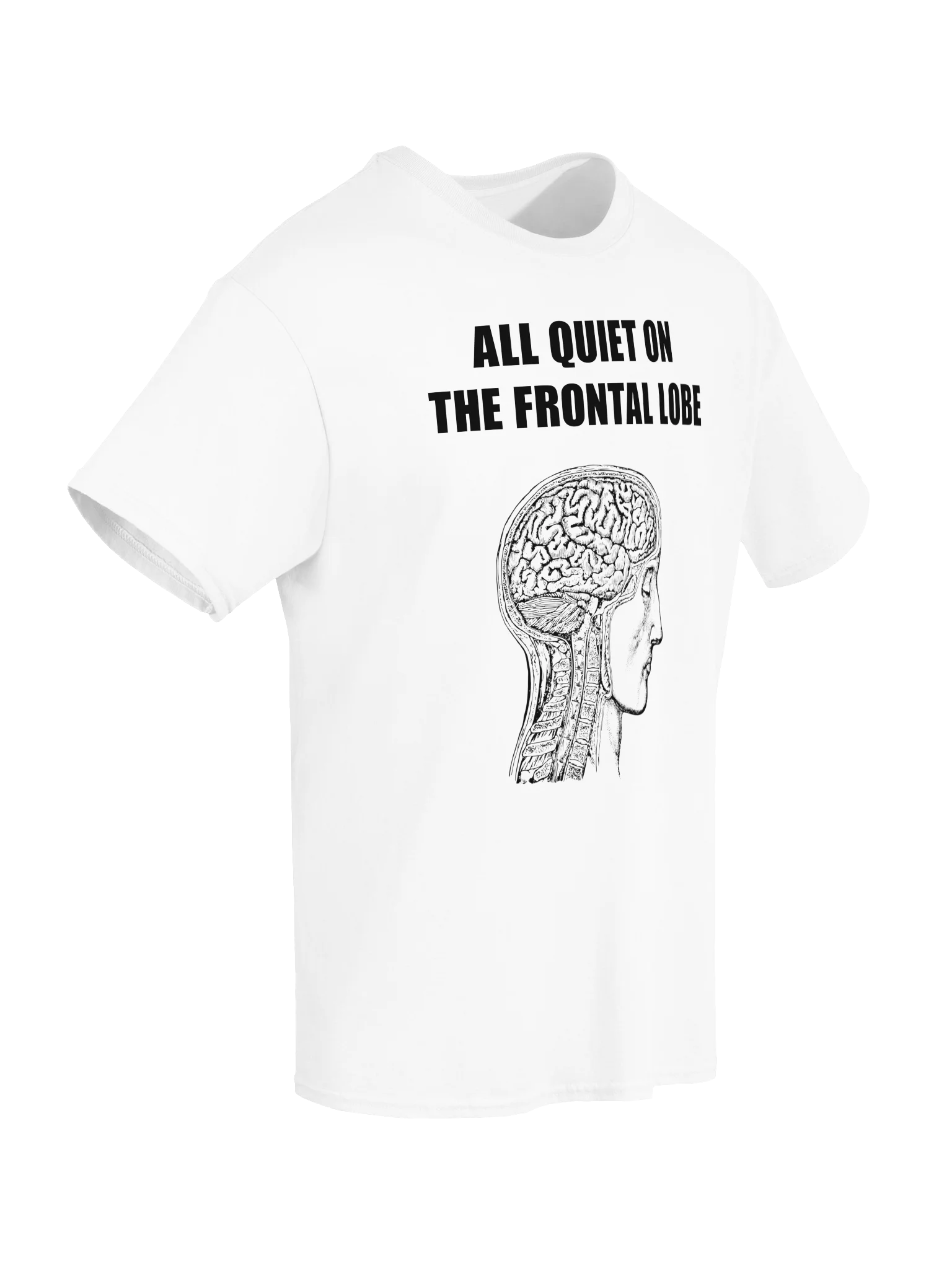ALL QUIET ON THE FRONTAL LOBE product image (6)