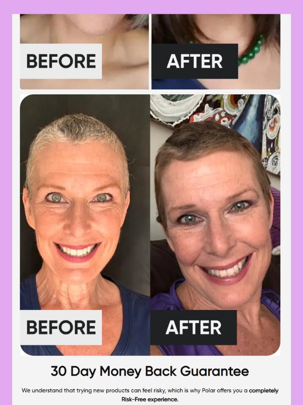 HairRevive Story – Gray Hair Solution Template product image (8)