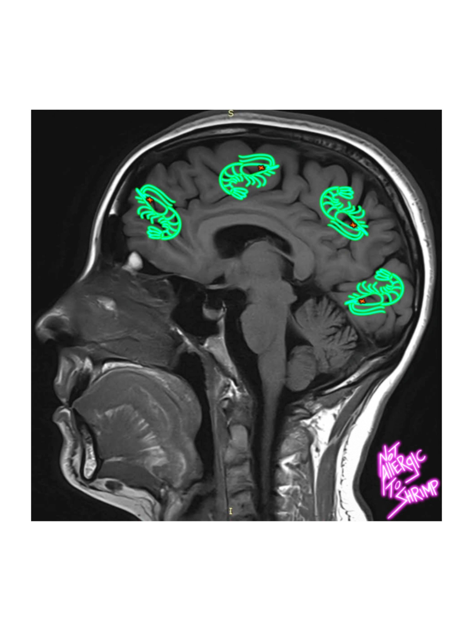 RADIOACTIVE SHRIMP ON THE MIND product image (1)