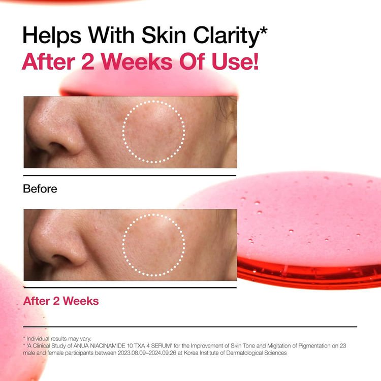 Anua Niacinamide 10% + TXA 4% Brightening Serum (30ml) product image (5)