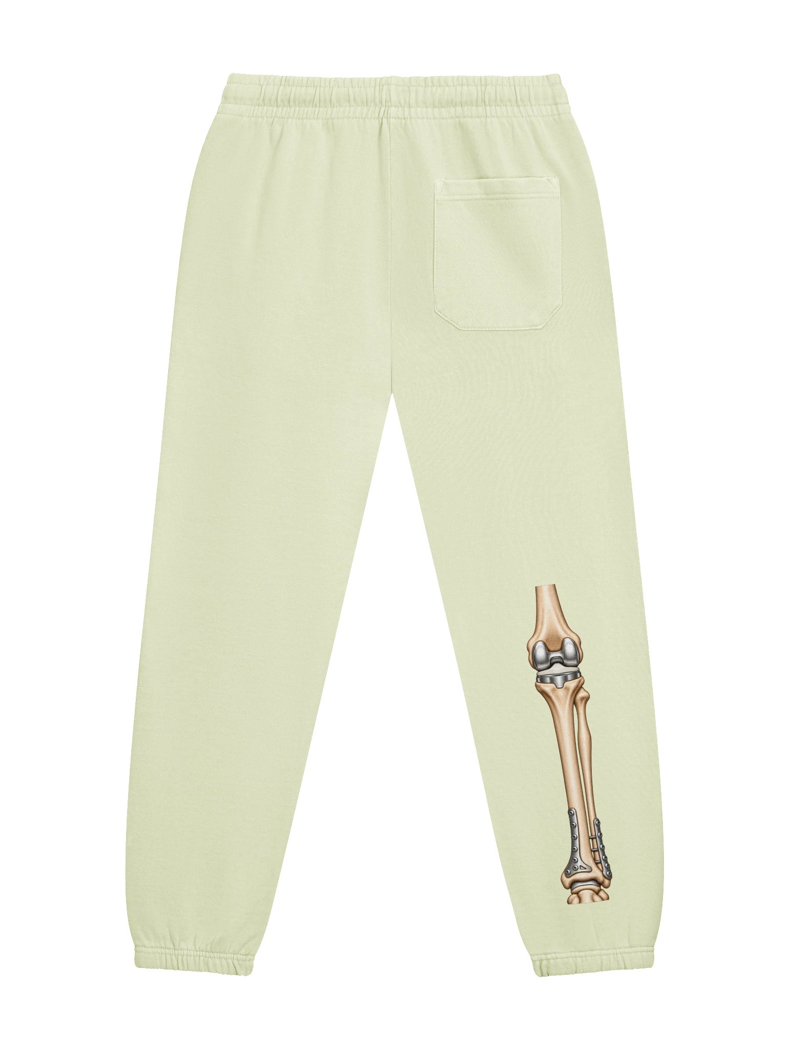 Right Knee Surgery Sweatpants — Aftermarket Parts Recovery Design | Rebuild Shop product image (4)