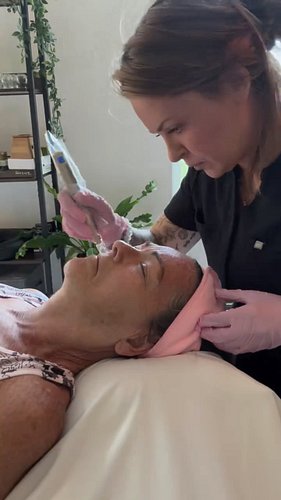 It’s hard to cut a video to 20 seconds from an hour long appointment, but here’s a little look at what microneedling looks li...