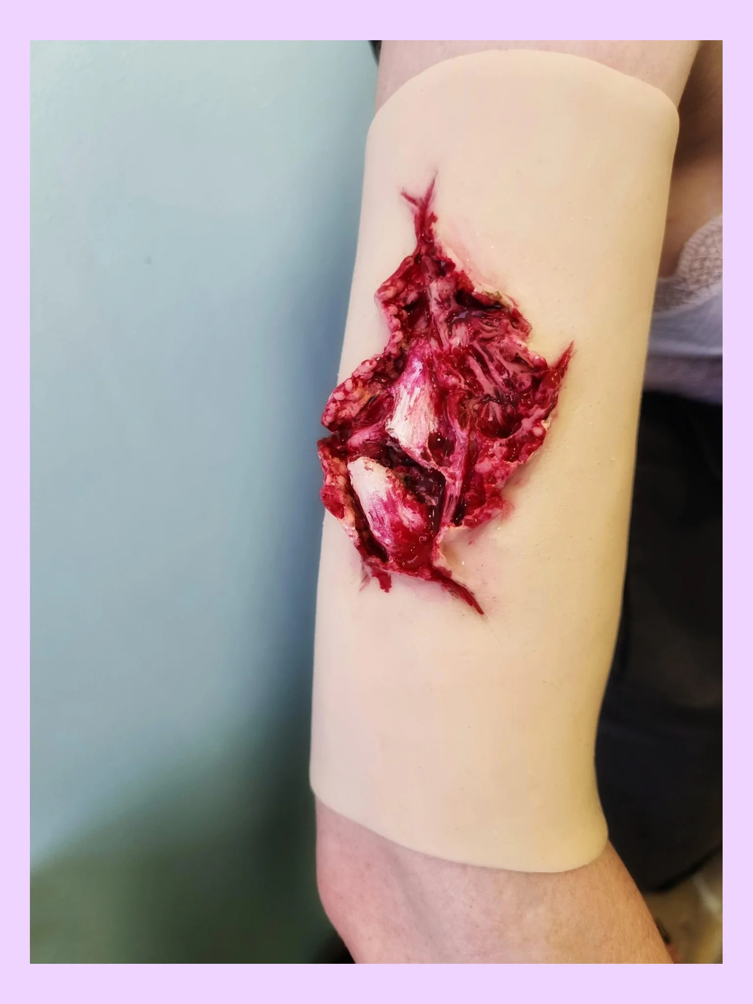 Hyperrealistic Wearable Open Fracture for Training product image (2)