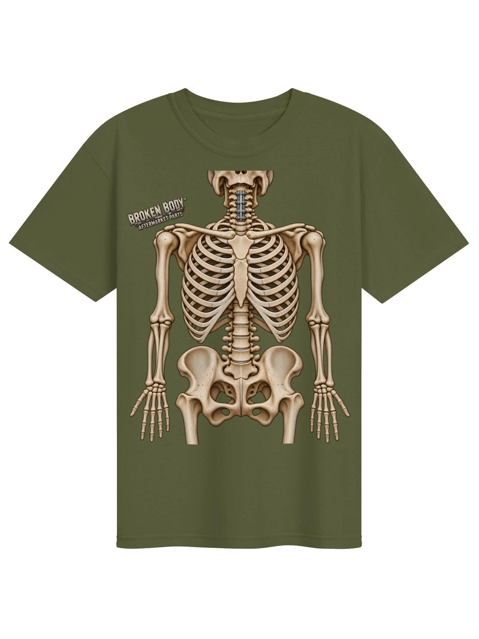 Neck Surgery Shirt — Aftermarket Parts Front & Back Tee | Rebuild Shop product image (2)