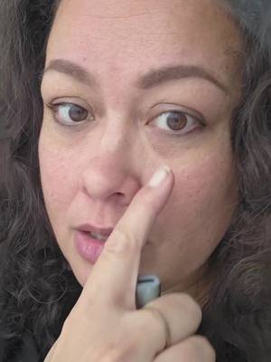 OMG! Can you see the difference? #redlightwand #redlighttherapy #skincare #selflove #identityshift 