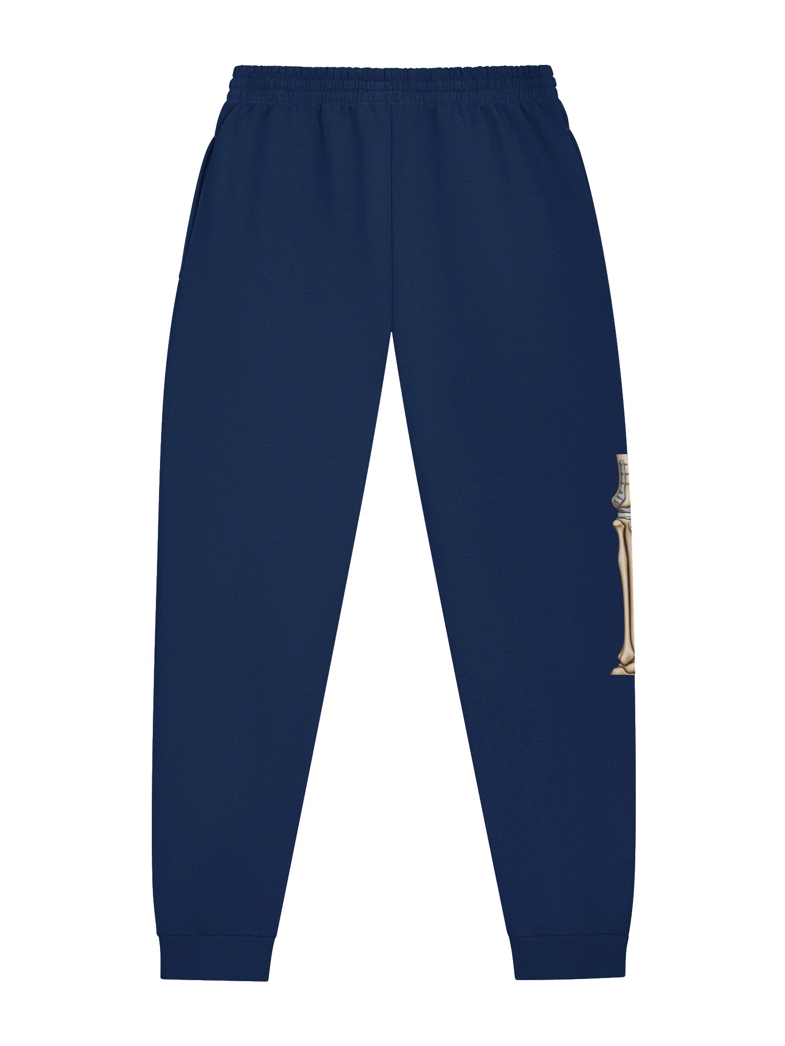 Right Knee Surgery Sweatpants — Aftermarket Parts Recovery Design | Rebuild Shop product image (3)