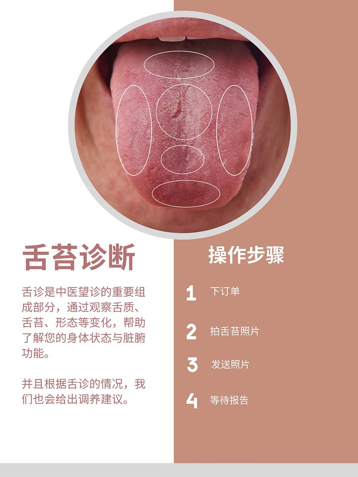 舌苔诊断报告服务 product image (1)
