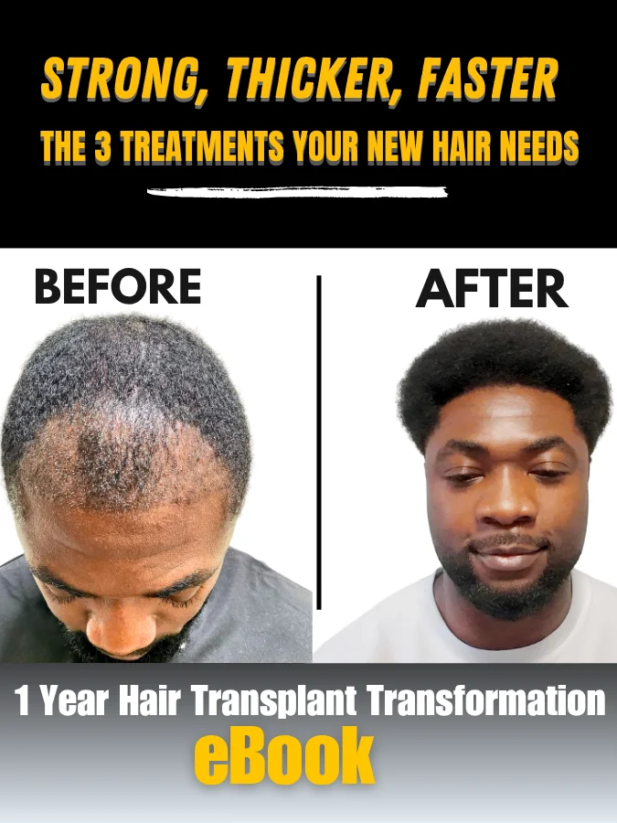 The 3 Best Post Hair Transplant Treatments (e-Book) product image (1)