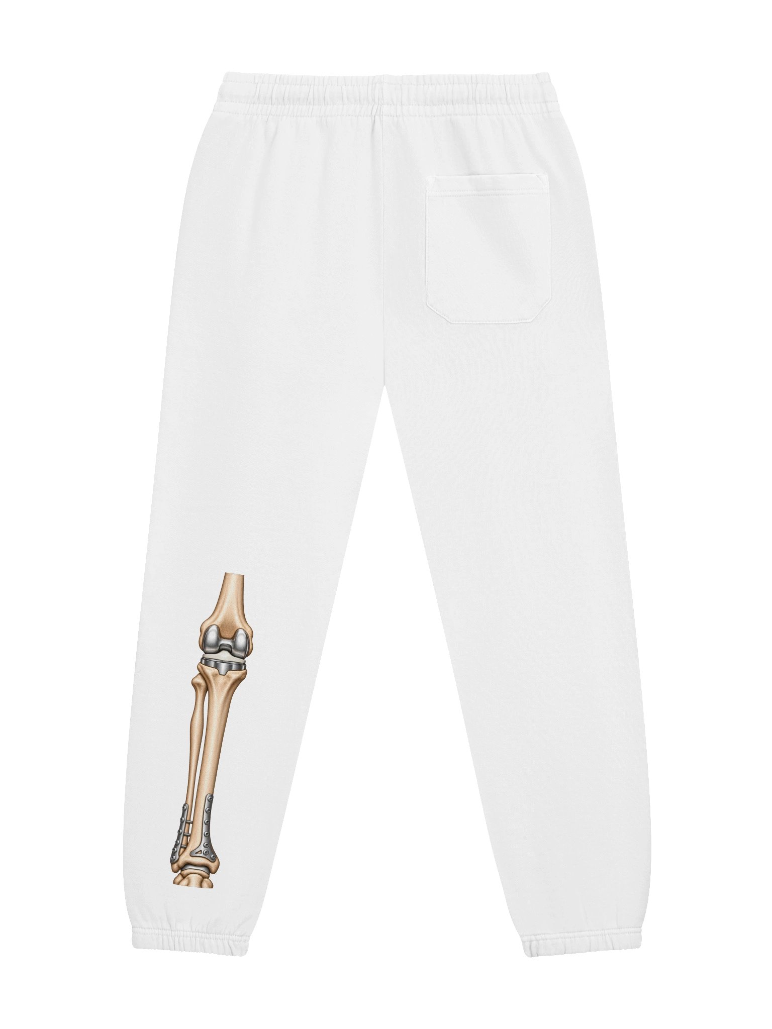 Left Knee Surgery Sweatpants — Aftermarket Parts Recovery Design | Rebuild Shop product image (4)