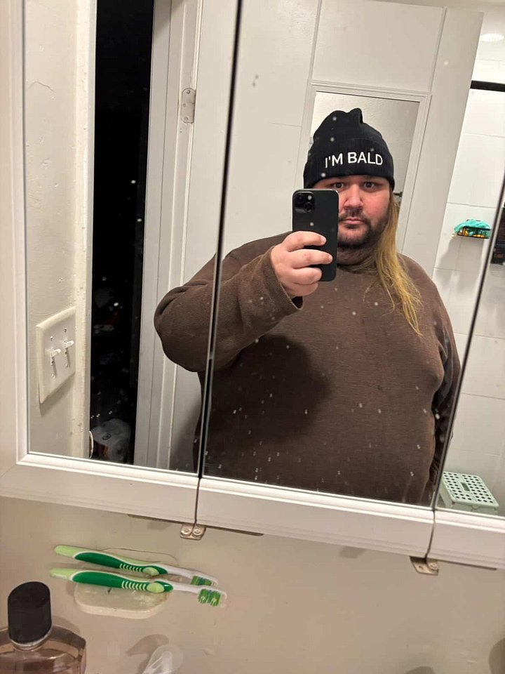 I'M BALD beanie product image (2)