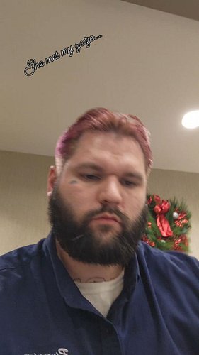 My sister almost burned alive. #autism #storytimewithellis #book #novel #writer #Ellis #theCHICKENteam