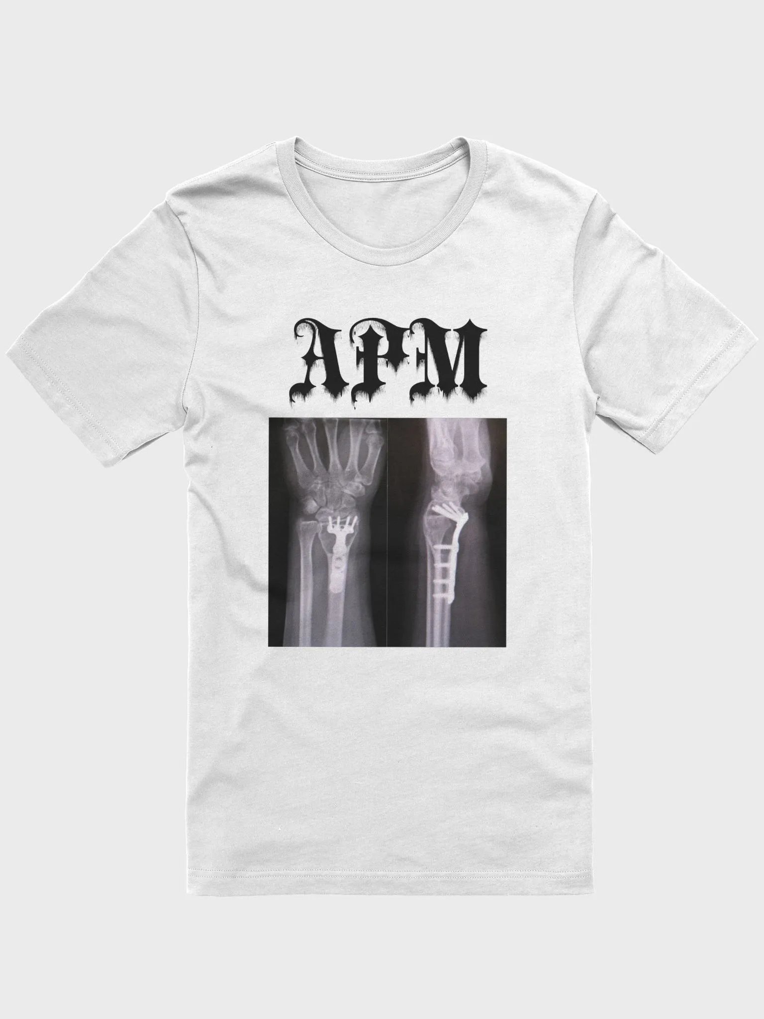 APM (white) product image (1)