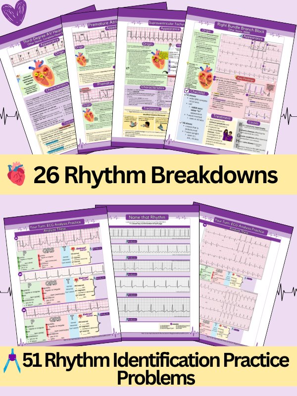 ECG/EKG Interpretation Study Guide & Workbook by Nurse Sarah® (Digital) product image (2)