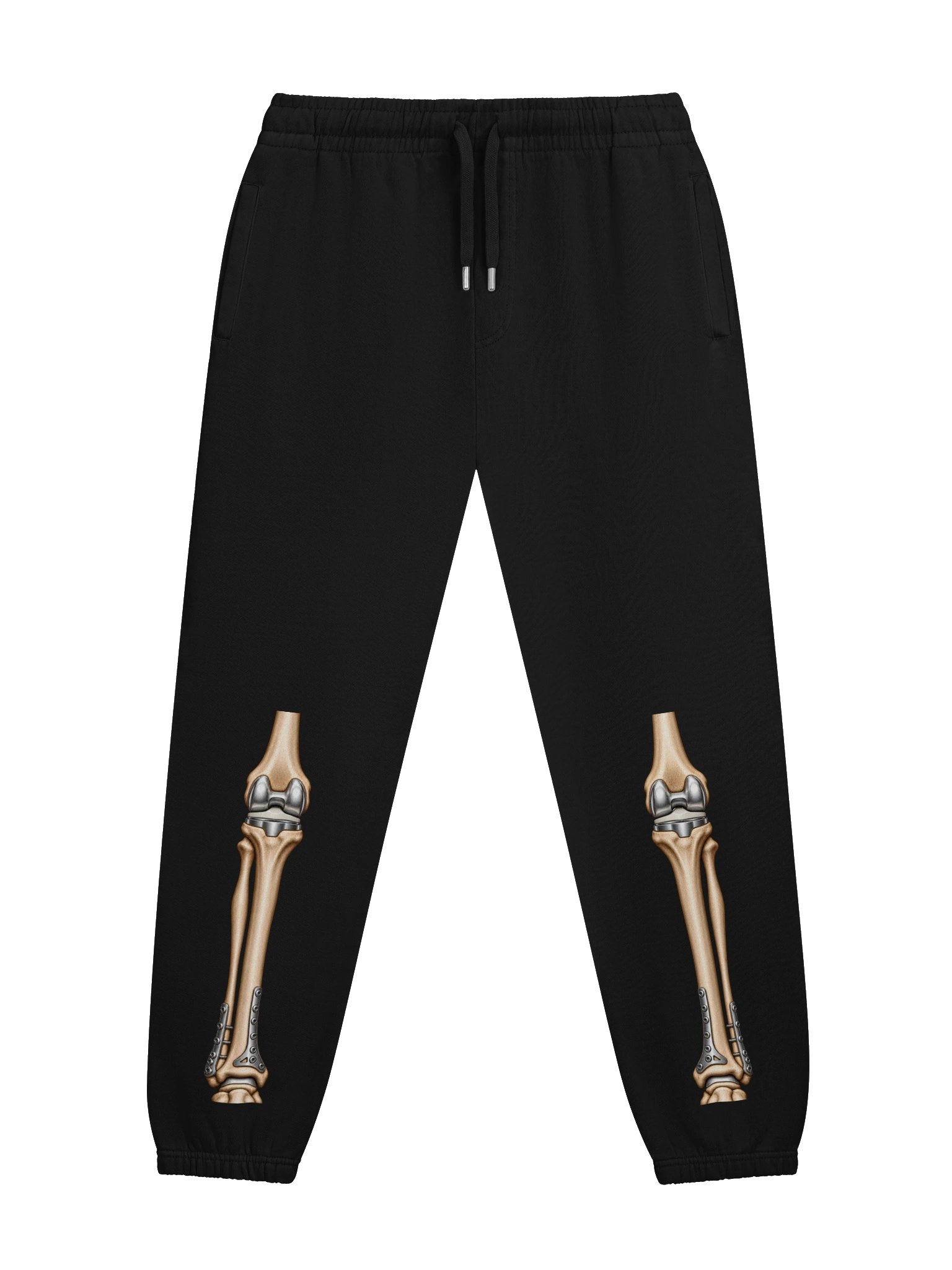 Double Knee Replacement Joggers — Aftermarket Parts Surgery Design | Rebuild Shop product image (2)