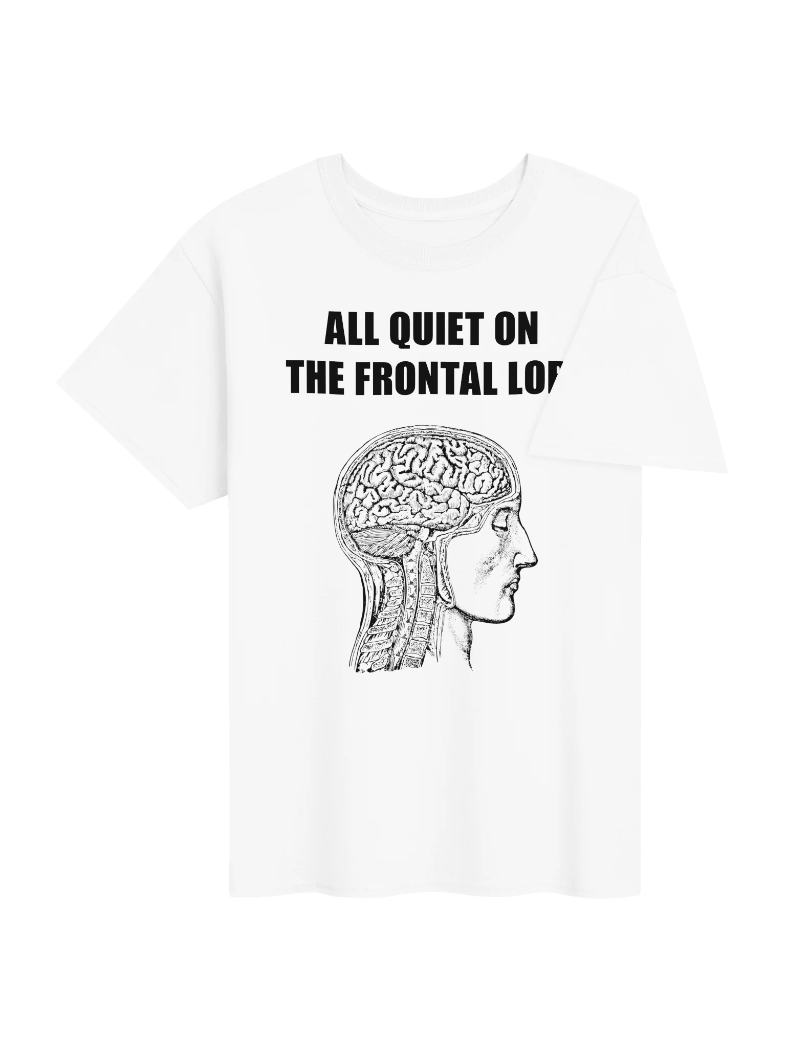 ALL QUIET ON THE FRONTAL LOBE product image (4)