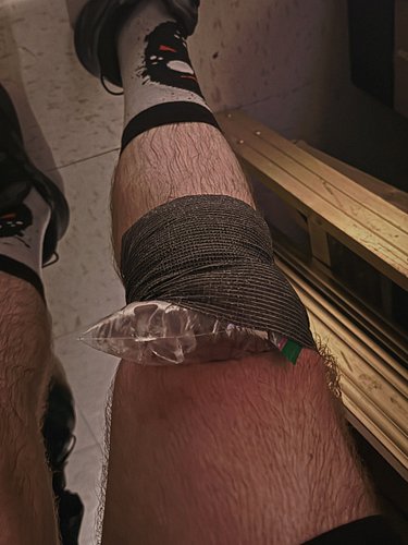 Womp womp — Partial tear in my medial meniscus. 
Here’s to #recovery 🍻
@bizarre_pro 
#SummerBizarre3